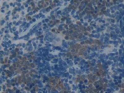 Plasminogen Activator Inhibitor 2 (PAI2) Rat Monoclonal Antibody