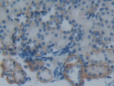 Plasminogen Activator Inhibitor 2 (PAI2) Rat Monoclonal Antibody