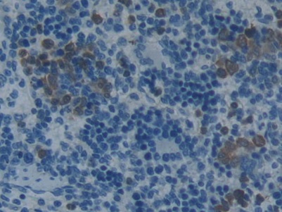 Plasminogen Activator Inhibitor 2 (PAI2) Rat Monoclonal Antibody