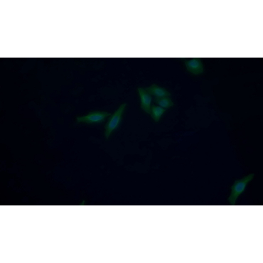 Enolase, Neuron Specific (NSE) Human Monoclonal Antibody