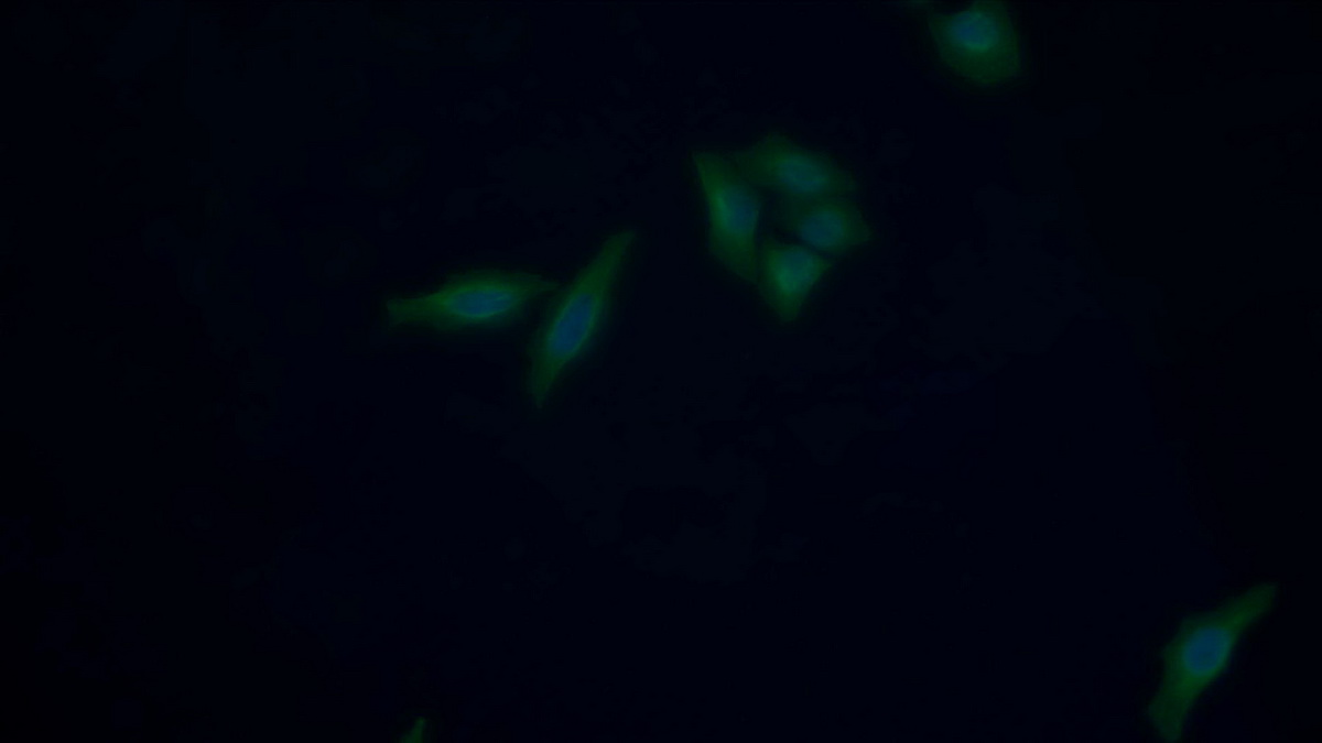 Enolase, Neuron Specific (NSE) Human Monoclonal Antibody