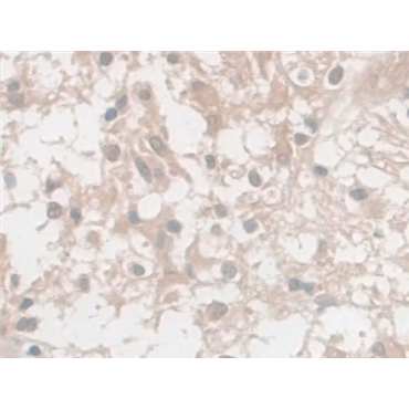 Enolase, Neuron Specific (NSE) Human Monoclonal Antibody