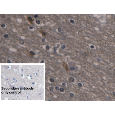 Enolase, Neuron Specific (NSE) Human Monoclonal Antibody