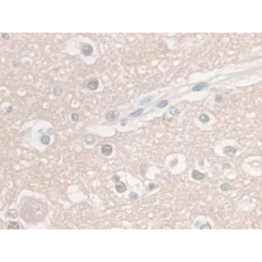 Enolase, Neuron Specific (NSE) Human Monoclonal Antibody