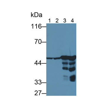 Enolase, Neuron Specific (NSE) Human Monoclonal Antibody