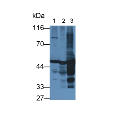 Enolase, Neuron Specific (NSE) Human Monoclonal Antibody