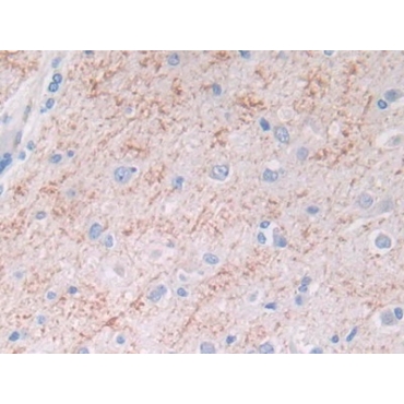 Brain Natriuretic Peptide (BNP) Human Monoclonal Antibody