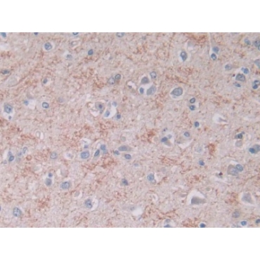 Brain Natriuretic Peptide (BNP) Human Monoclonal Antibody