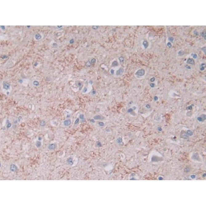 Brain Natriuretic Peptide (BNP) Human Monoclonal Antibody