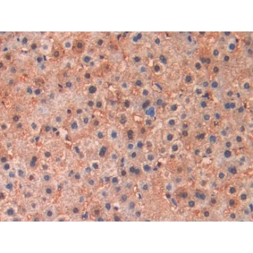 Brain Natriuretic Peptide (BNP) Human Monoclonal Antibody