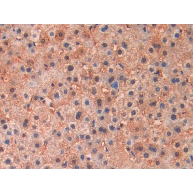 Brain Natriuretic Peptide (BNP) Human Monoclonal Antibody