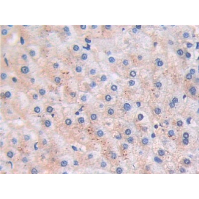 Brain Natriuretic Peptide (BNP) Human Monoclonal Antibody