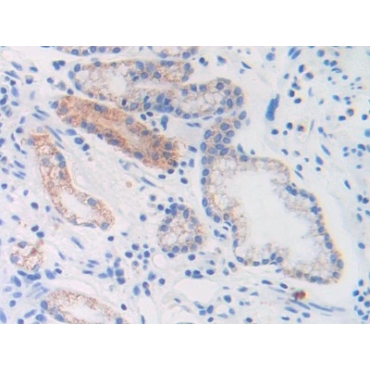 Brain Natriuretic Peptide (BNP) Human Monoclonal Antibody