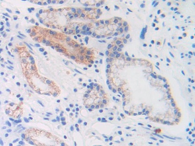 Brain Natriuretic Peptide (BNP) Human Monoclonal Antibody