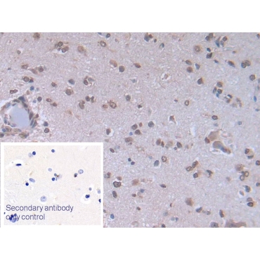 Brain Natriuretic Peptide (BNP) Human Monoclonal Antibody