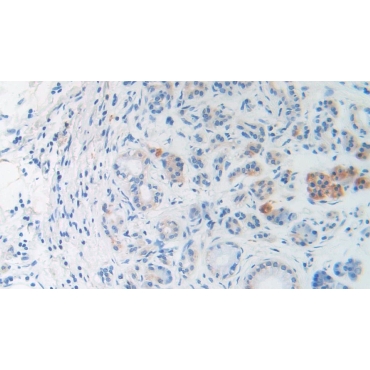 Brain Natriuretic Peptide (BNP) Human Monoclonal Antibody