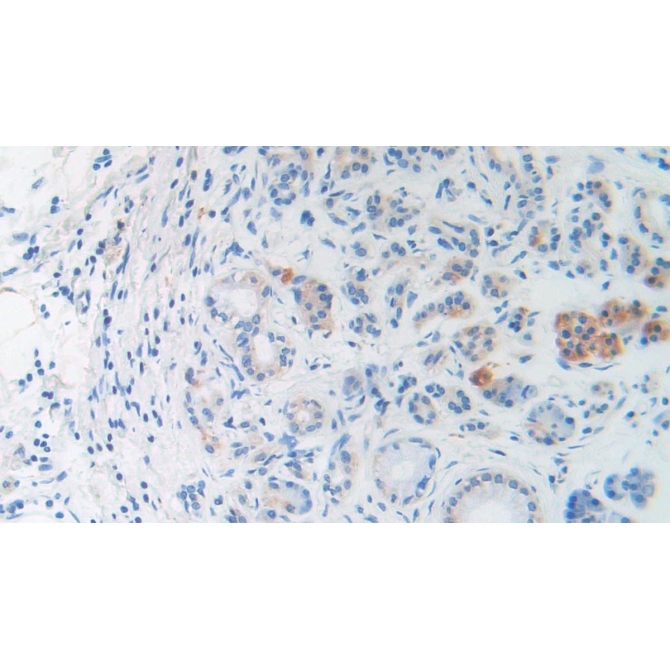 Brain Natriuretic Peptide (BNP) Human Monoclonal Antibody