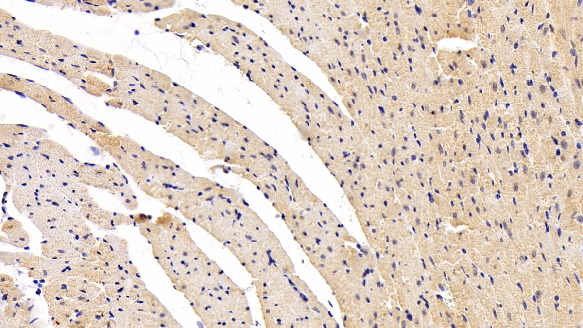 Brain Natriuretic Peptide (BNP) Rat Monoclonal Antibody