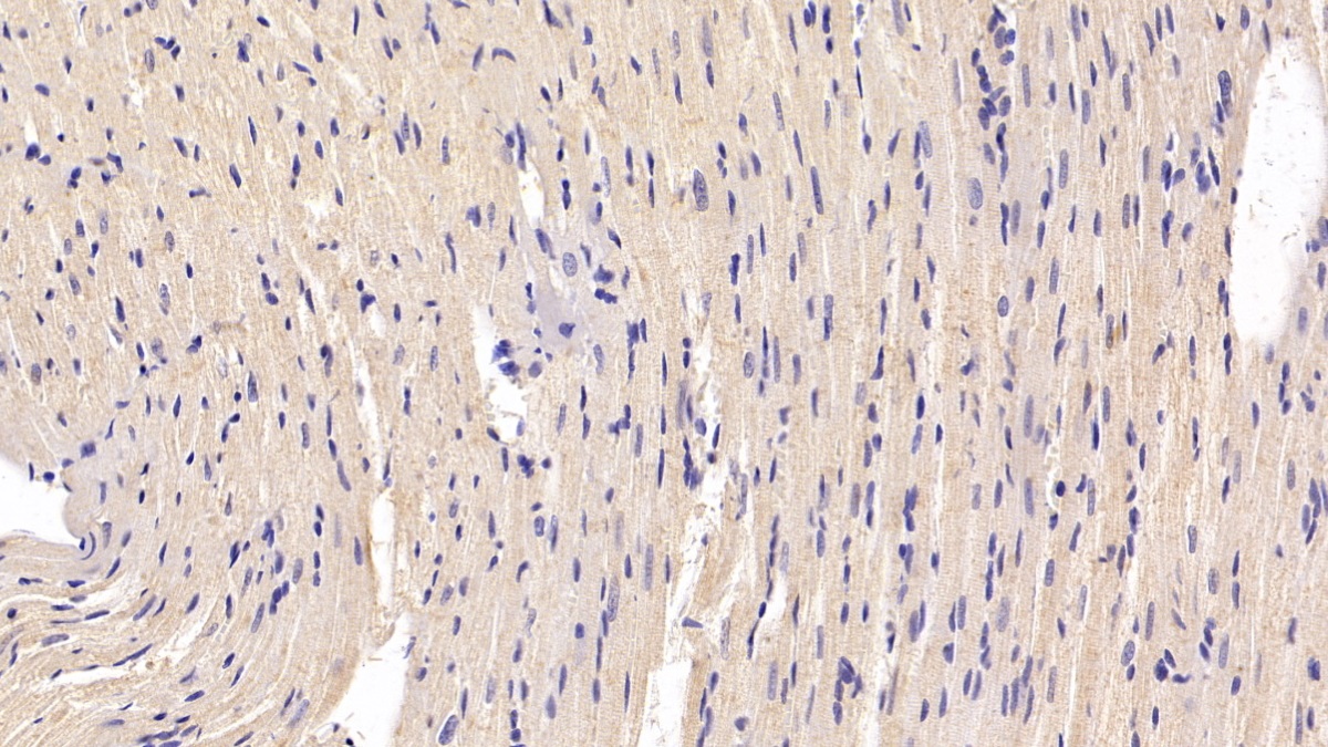 Brain Natriuretic Peptide (BNP) Rat Monoclonal Antibody