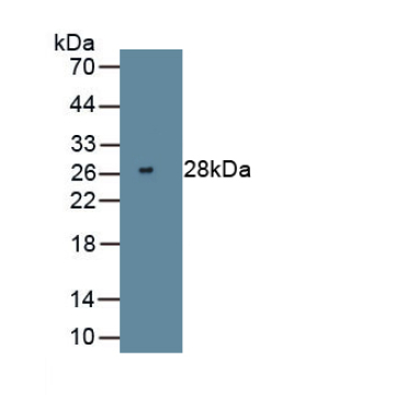 Vascular Cell Adhesion Molecule 1 (VCAM1) Human Monoclonal Antibody