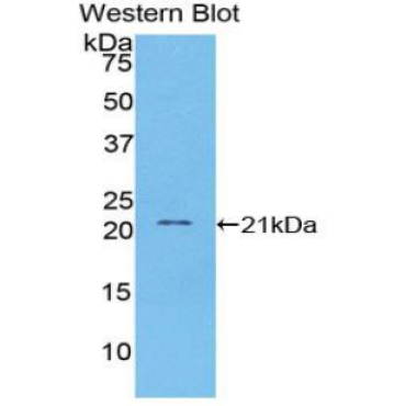 Vascular Cell Adhesion Molecule 1 (VCAM1) Human Monoclonal Antibody