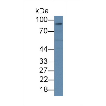 Intercellular Adhesion Molecule 1 (ICAM1) Human Monoclonal Antibody