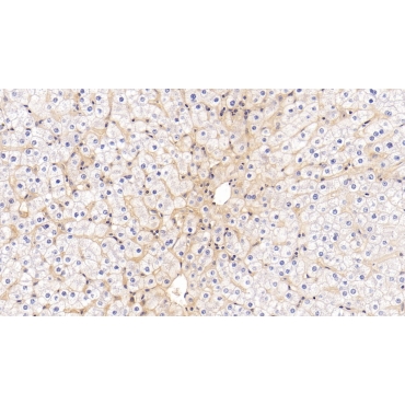 Intercellular Adhesion Molecule 1 (ICAM1) Human Monoclonal Antibody