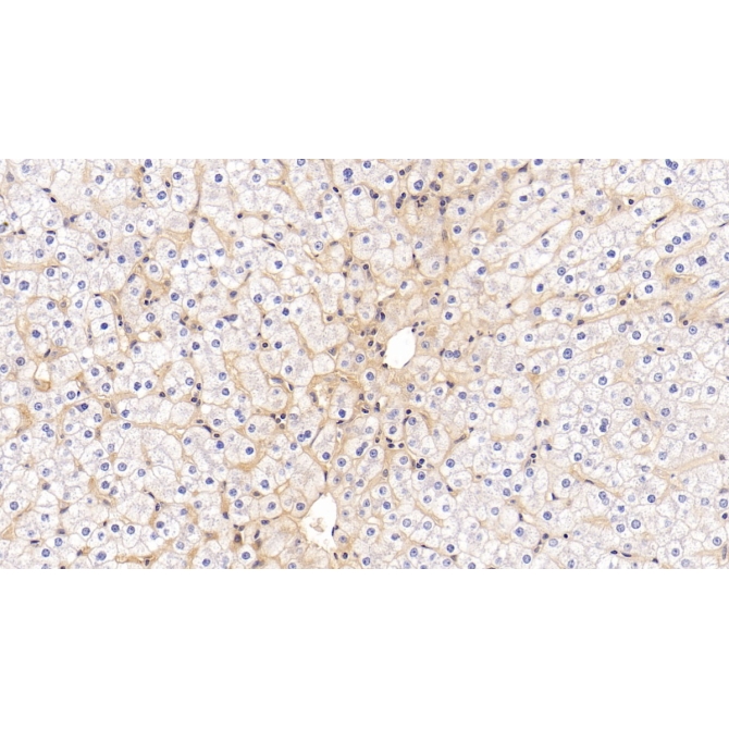 Intercellular Adhesion Molecule 1 (ICAM1) Human Monoclonal Antibody