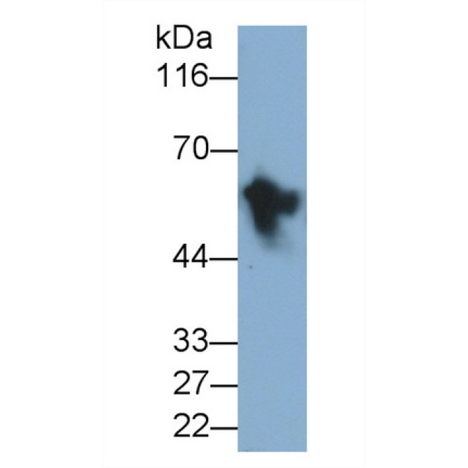 Intercellular Adhesion Molecule 1 (ICAM1) Human Monoclonal Antibody