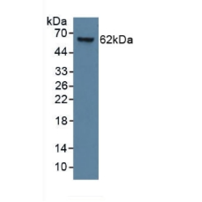 Cytokeratin 9 (CK9) Human Monoclonal Antibody