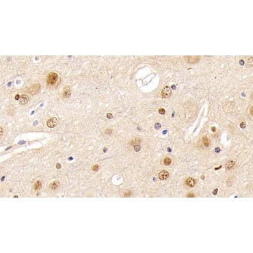 Fibroblast Growth Factor 2, Basic (FGF2) Human Monoclonal Antibody
