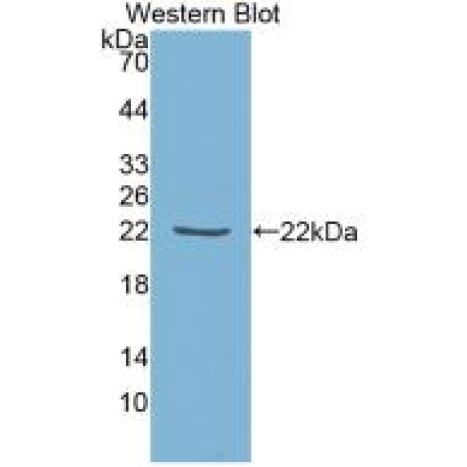 Tissue Inhibitors Of Metalloproteinase 1 (TIMP1) Human Monoclonal Antibody