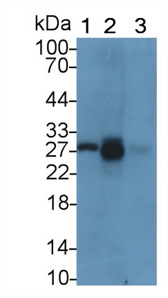 Tissue Inhibitors Of Metalloproteinase 1 (TIMP1) Human Monoclonal Antibody