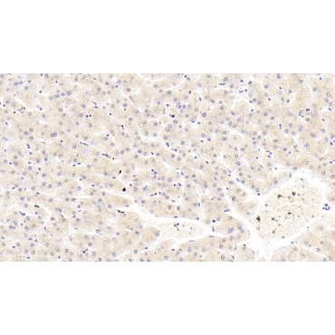 Tissue Inhibitors Of Metalloproteinase 1 (TIMP1) Human Monoclonal Antibody