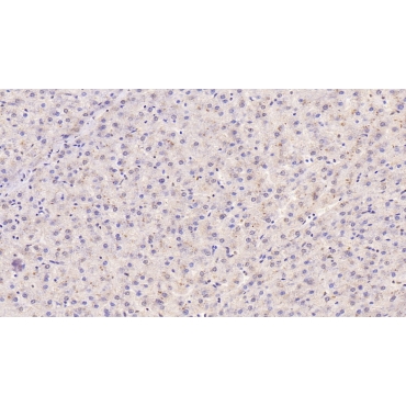 Tissue Inhibitors Of Metalloproteinase 1 (TIMP1) Human Monoclonal Antibody