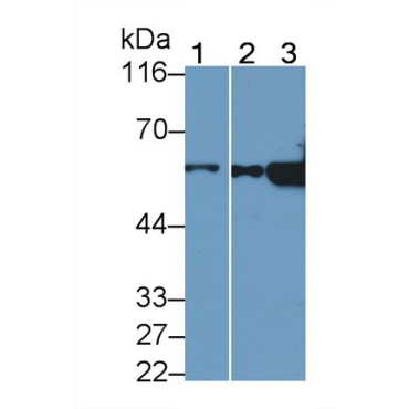 Cytokeratin 7 (CK7) Human Monoclonal Antibody