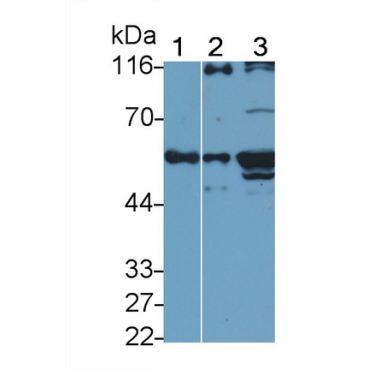 Cytokeratin 7 (CK7) Human Monoclonal Antibody