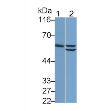 Cytokeratin 7 (CK7) Human Monoclonal Antibody
