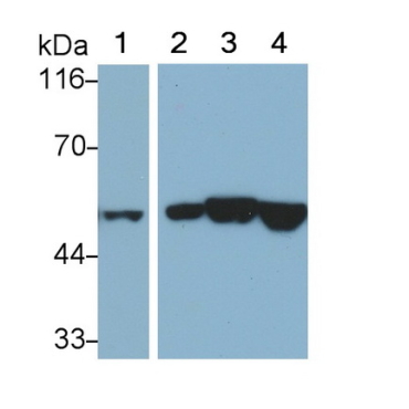 Cytokeratin 7 (CK7) Human Monoclonal Antibody