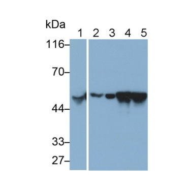 Cytokeratin 7 (CK7) Human Monoclonal Antibody