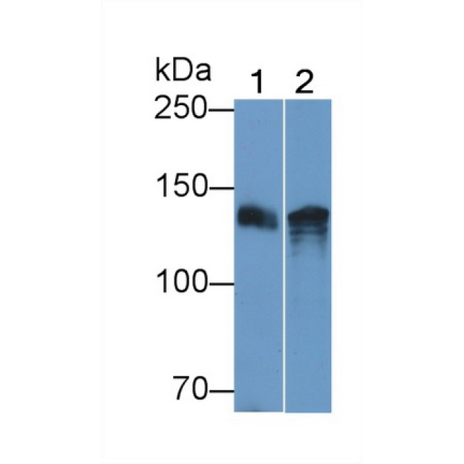 Epidermal Growth Factor (EGF) Human Monoclonal Antibody