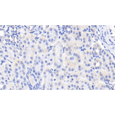 Epidermal Growth Factor (EGF) Human Monoclonal Antibody