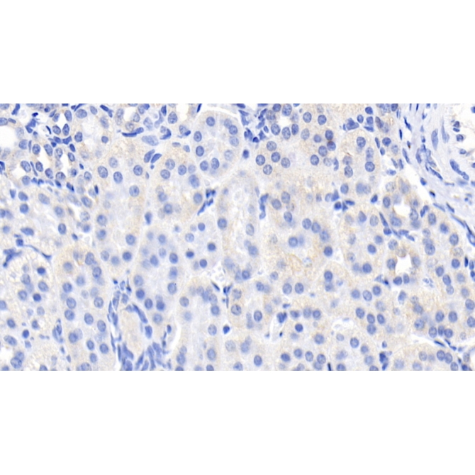 Epidermal Growth Factor (EGF) Human Monoclonal Antibody