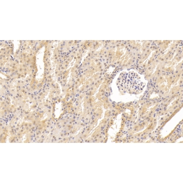 Epidermal Growth Factor (EGF) Human Monoclonal Antibody