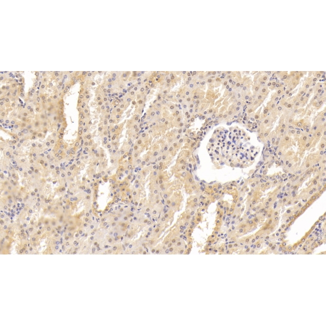 Epidermal Growth Factor (EGF) Human Monoclonal Antibody