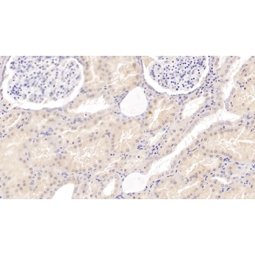 Epidermal Growth Factor (EGF) Human Monoclonal Antibody