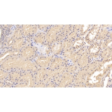 Epidermal Growth Factor (EGF) Human Monoclonal Antibody