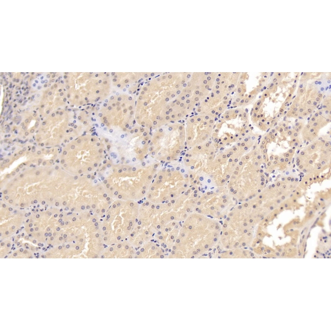 Epidermal Growth Factor (EGF) Human Monoclonal Antibody