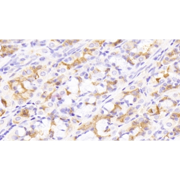 Epidermal Growth Factor (EGF) Human Monoclonal Antibody