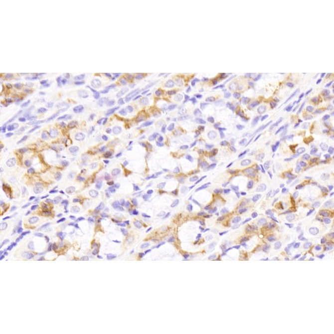 Epidermal Growth Factor (EGF) Human Monoclonal Antibody